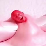 Акне