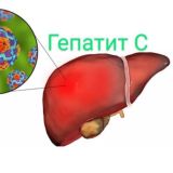 Гепатит С