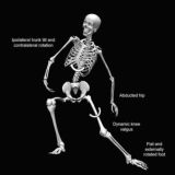 Science of Biomechanics, Sports Injuries, Pain and Musculoskeletal disorders