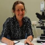 Barbara O'Neill