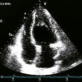 Эхокардиография/Кардиология/Echocardiography/Cardiology🫀👨⚕